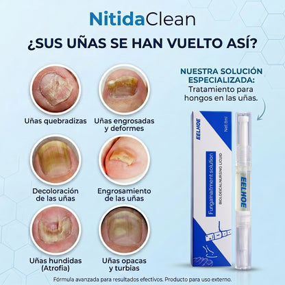Lápiz para el cuidado de uñas — NitidaClean 3 ml